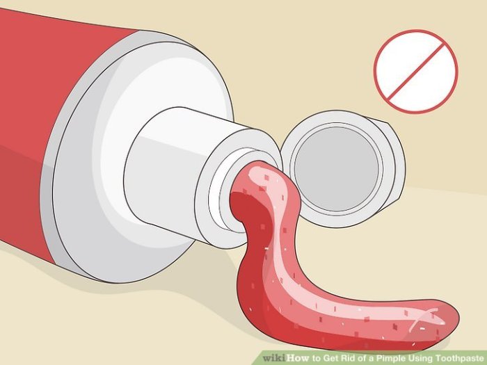Does Toothpaste For Acne Really Work? 7 Kinda-Crazy Home Remedies For Pimples, Plus How ... Does using toothpaste on pimples really work