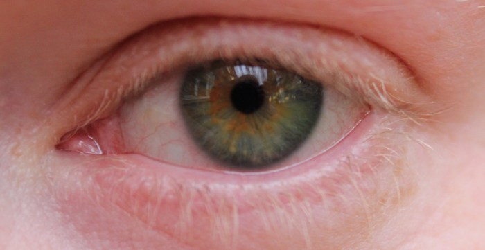 Blue Eye Of Woman Free Stock Photo - Public Domain Pictures What does an eye doctor do