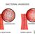Bacterial Vaginosis in Men A Deep Dive