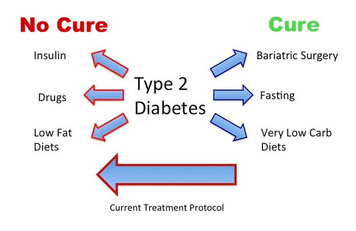 Type 2 diabetes causes risk factors