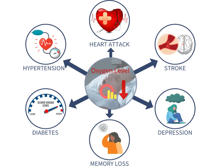Sleep apnea and oxygen desaturation
