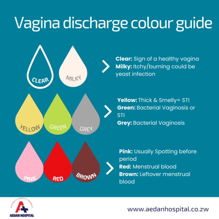Vaginal discharge color guide