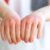 Signs of Gluten Allergy A Comprehensive Guide
