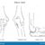 Itchy Bumps on Elbows A Comprehensive Guide