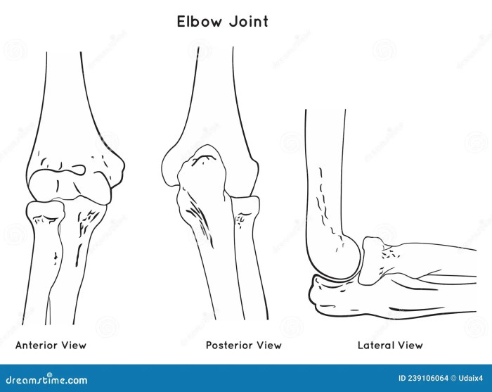 Itchy bumps on elbows