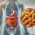 Treating Small Intestinal Bacterial Overgrowth