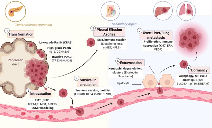 Outside the exam room metastatic breast cancer