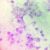 What Does Gonorrhea Look Like? A Visual Guide