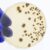 Fungal Lung Infection vs. Cancer A Deep Dive