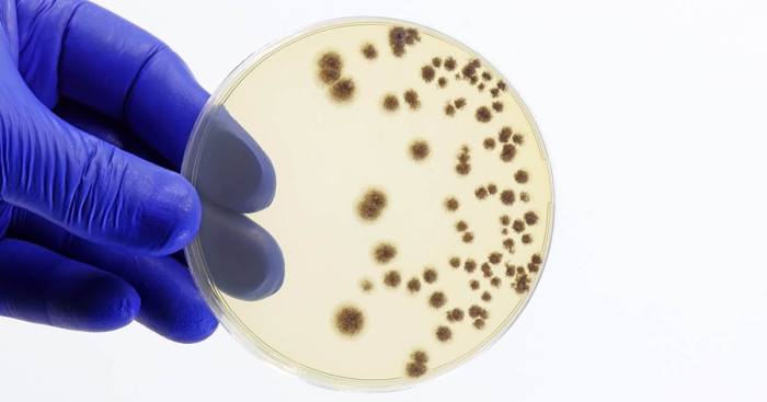 Fungal Lung Infection vs. Cancer A Deep Dive
