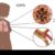 COPD and Herbal Remedies A Holistic Approach