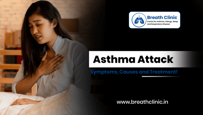 Severe Asthma Attack Recovery Time A Guide