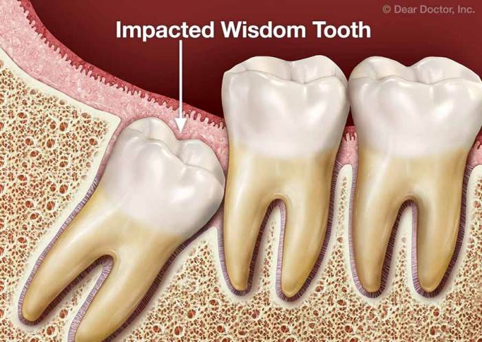 How many teeth do adults have