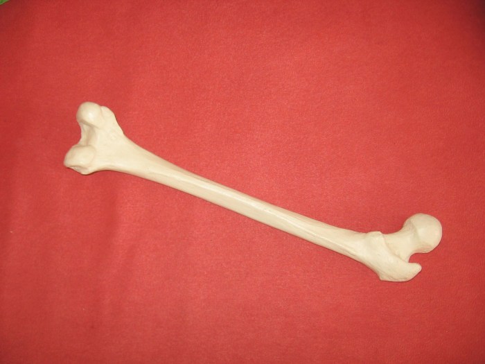 What is a bone scan for cancer