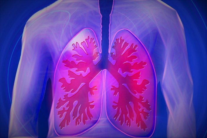 Lung Cancer in Women A Comprehensive Guide