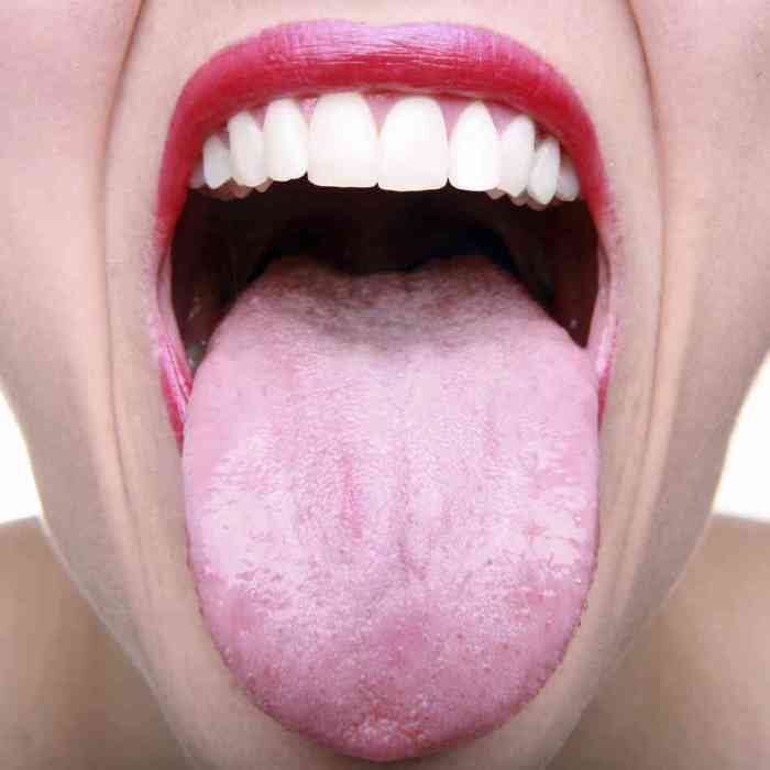 Open cartoon mouth with tongue sticking out Stock Vector | Adobe Stock Mouth throat appearance tonsillectomy