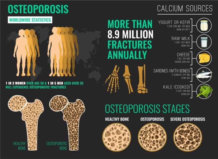 Is osteoporosis a disability