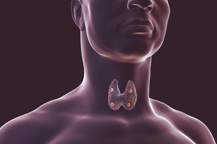 Parathyroid hormone blood test