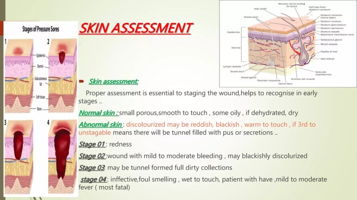 Pressure sore 23426 | PPT Knowing a pressure ulcer has begun