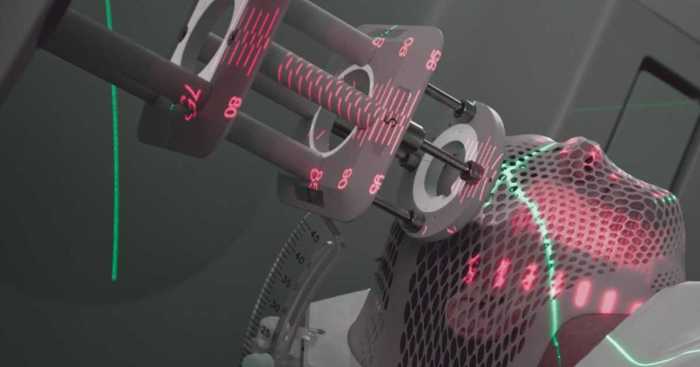 A Comprehensive Guide on How to Reduce Side Effects of Radiation Therapy Managing effects of radiation therapy