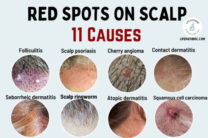 Scabs on scalp causes diagnosis and treatment
