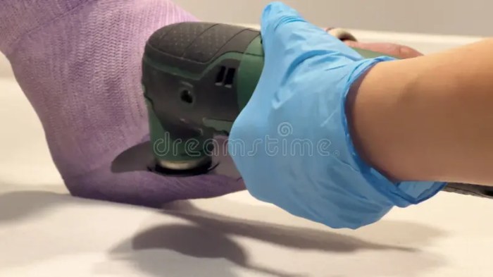 How to safely remove a cast with a cast saw