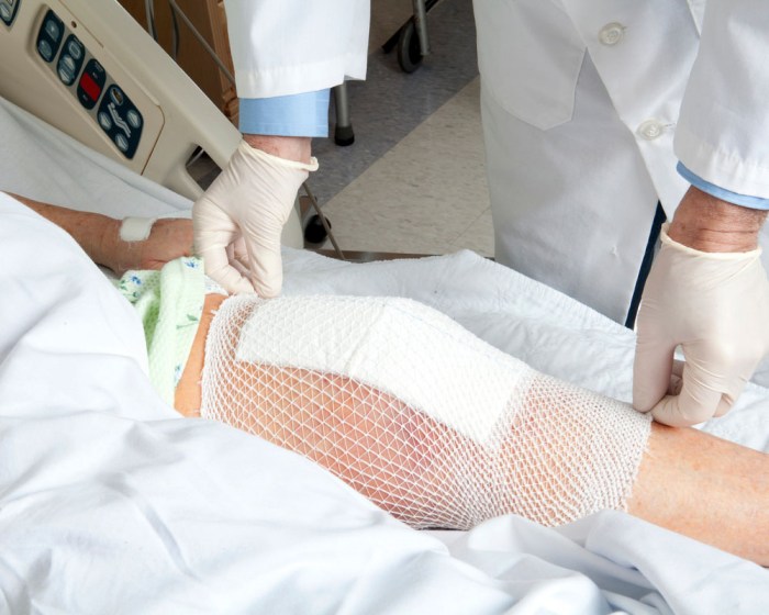 What are the complications in knee replacement surgery? by AOSM Delhi ... Complications of knee replacement