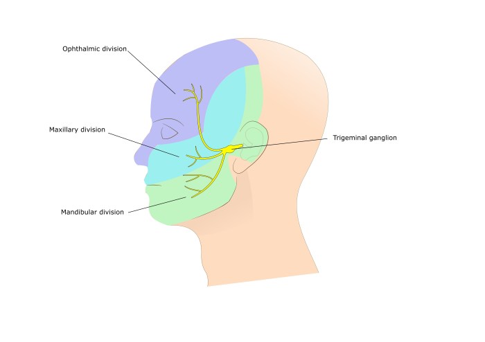 What is Trigeminal Neuralgia? A Deep Dive