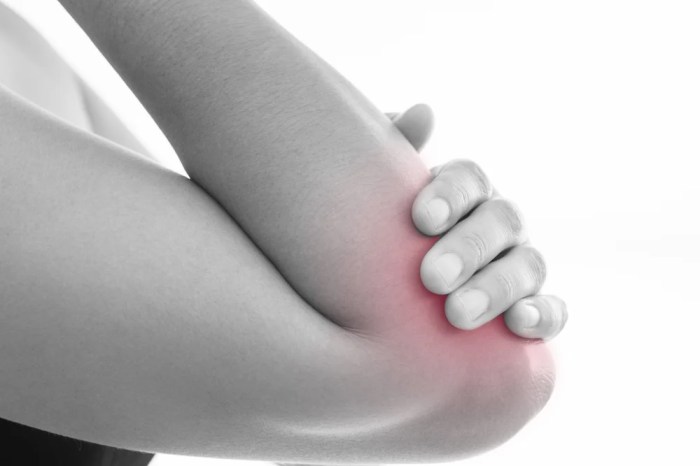 Bursitis inflammation swelling joints