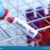 Sodium Blood Test Results A Deep Dive
