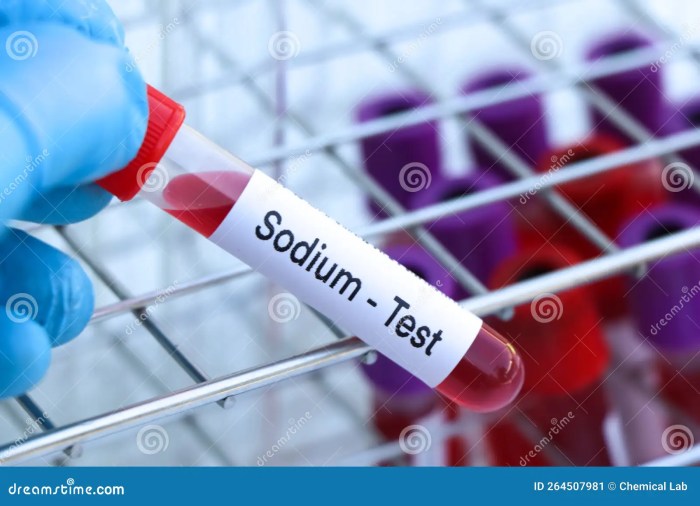 Sodium Blood Test Results A Deep Dive