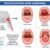 Sore Throat and Allergies A Deep Dive