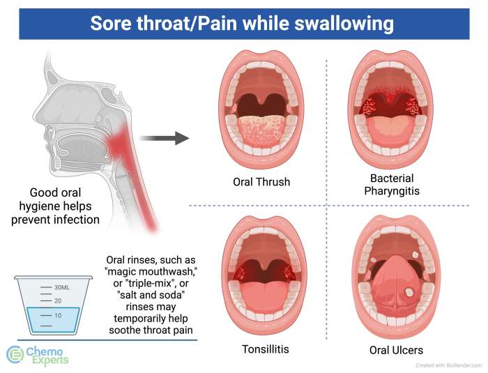 Sore Throat and Allergies A Deep Dive
