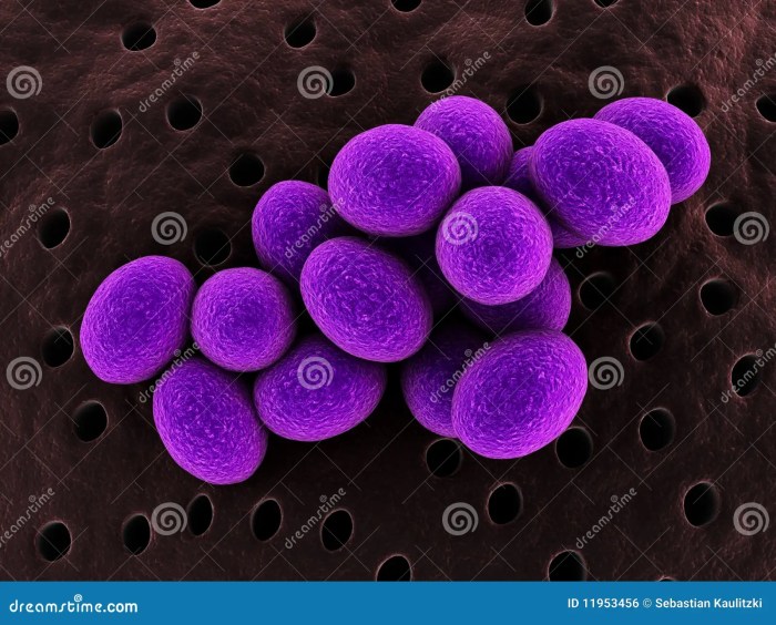 Staphylococcus Royalty Free Stock Image - Image: 11953456 Staph infection vs mrsa
