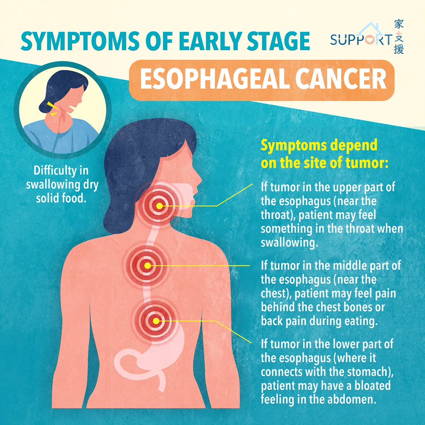 Esophageal cancer causes and risk factors