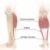 Calf Pain When Walking Understanding Causes & Relief