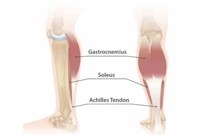 Calf pain when walking