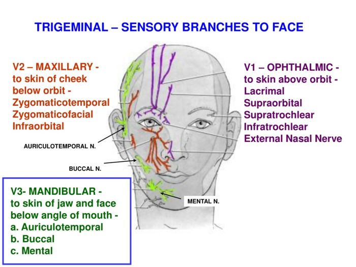 What is trigeminal neuralgia