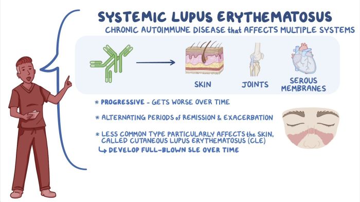 Lupus and birth control