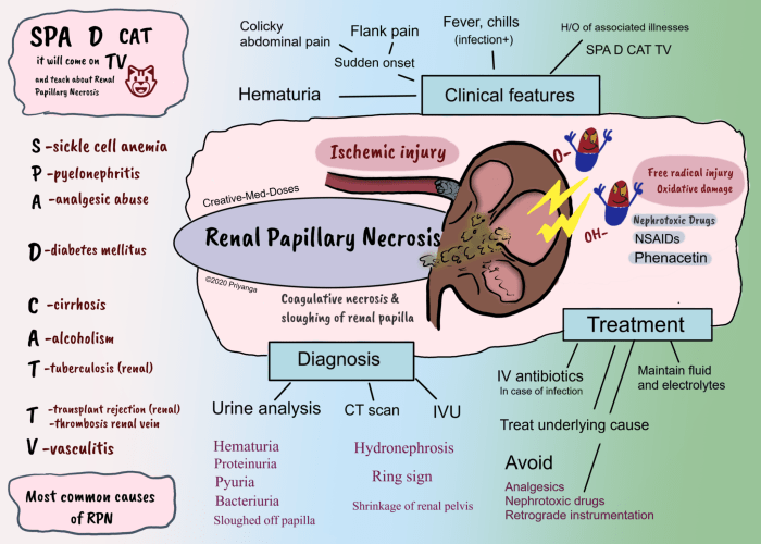 Renal Papillary Necrosis (RPN) - Creative Med Doses How renal cell carcinoma is treated