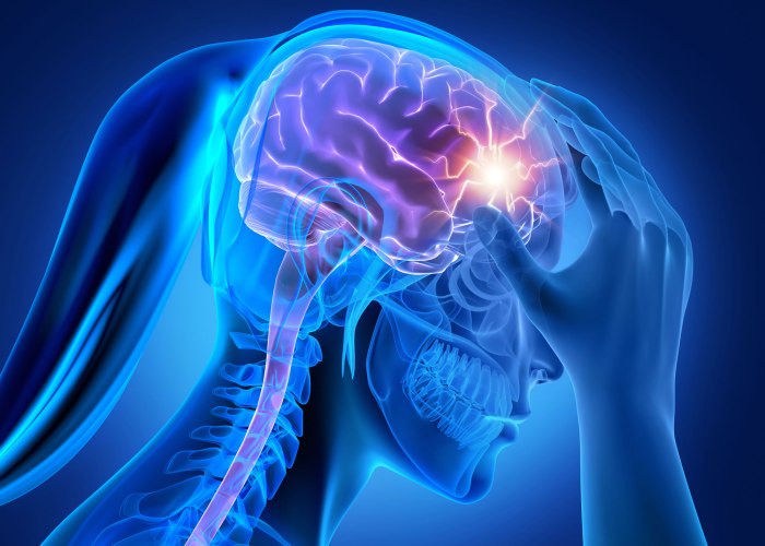 How concussions are diagnosed