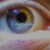 What is the Rarest Eye Color? Unveiled