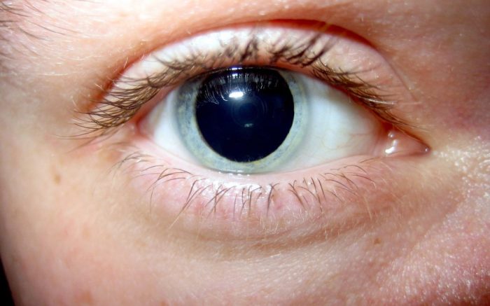 Iris of the eye