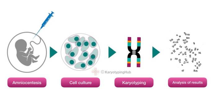 How to how is a karyotype test done