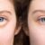 How to Get Rid of Puffy Eyes A Comprehensive Guide