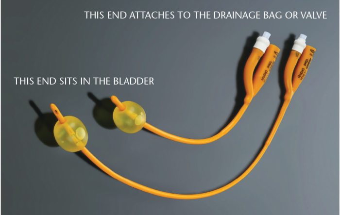 What is a foley catheter