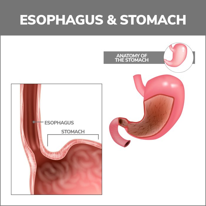 Esophageal Disorders | Gastroenterology of Greater Orlando Esophagus function and conditions