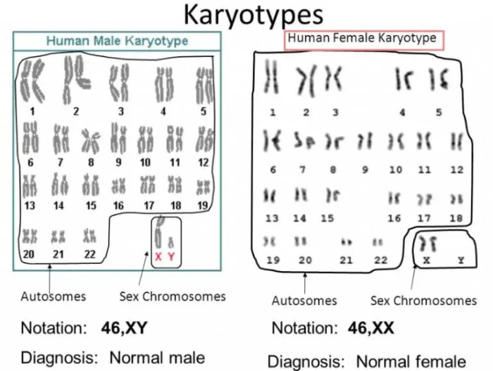 How to how is a karyotype test done