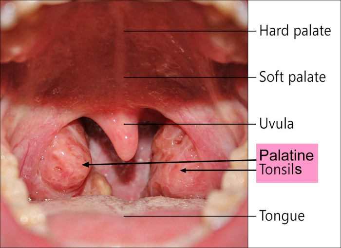 Sore throat at night