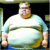 Overview of Fatty Liver Disease A Comprehensive Guide